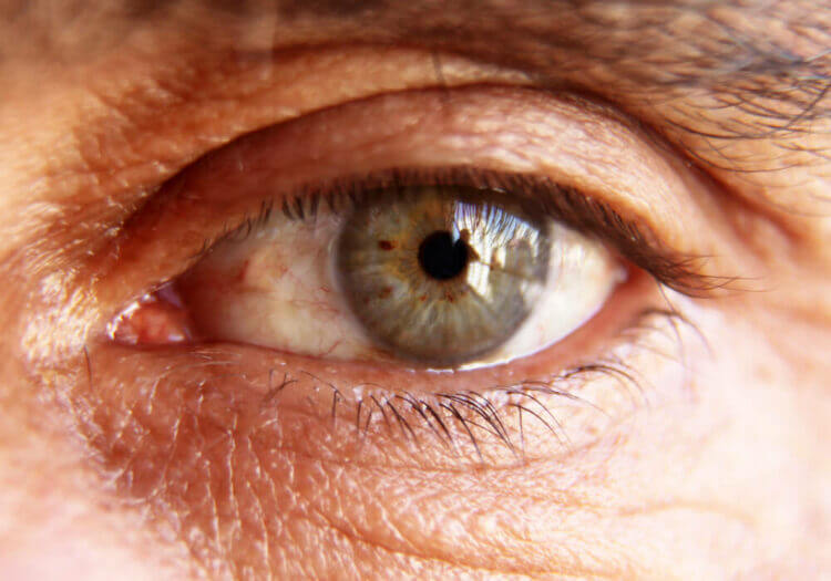 diabetic-eye-disease-ashland-diabetic-retinopathy-ashland-ky